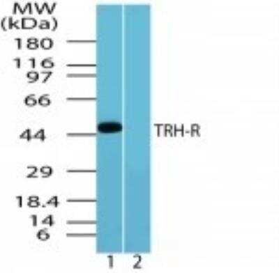 Western Blot: TRHR Antibody [NBP2-24726]