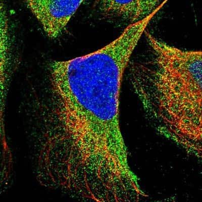 Immunocytochemistry/ Immunofluorescence: TRIAD3 Antibody [NBP1-86907]