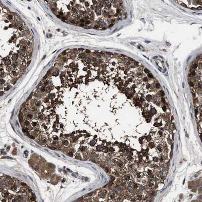 Immunohistochemistry-Paraffin: TRIAD3 Antibody [NBP1-86906]