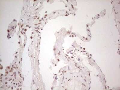 Immunohistochemistry: TRIB1 Antibody (OTI8C8) - Azide and BSA Free [NBP2-74596]