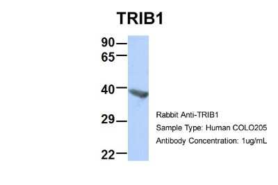 Western Blot: TRIB1 Antibody [NBP1-55386]