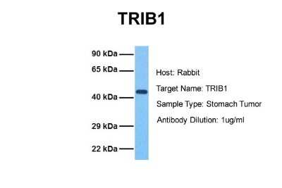 Western Blot: TRIB1 Antibody [NBP1-55386]
