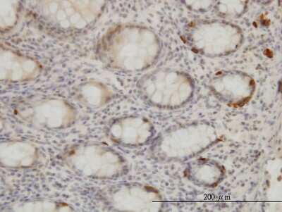 Immunohistochemistry-Paraffin: TRIB2 Antibody (1B1) [H00028951-M04]
