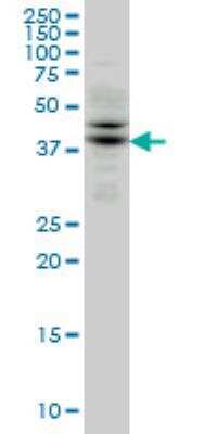 Western Blot: TRIB2 Antibody (1B1) [H00028951-M04]