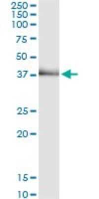 Immunoprecipitation: TRIB2 Antibody (1D11) [H00028951-M11]
