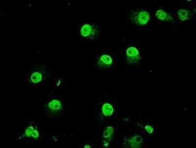 Immunocytochemistry/ Immunofluorescence: TRIB2 Antibody (OTI8D11) [NBP1-48030]