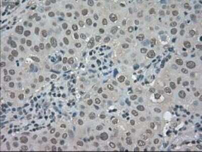 Immunohistochemistry-Paraffin: TRIB2 Antibody (OTI8D11) [NBP1-48030]