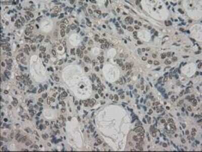 Immunohistochemistry-Paraffin: TRIB2 Antibody (OTI8D11) [NBP1-48030]