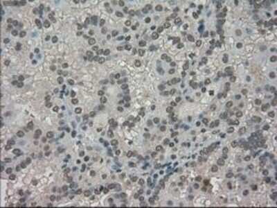 Immunohistochemistry-Paraffin: TRIB2 Antibody (OTI8D11) [NBP1-48030]