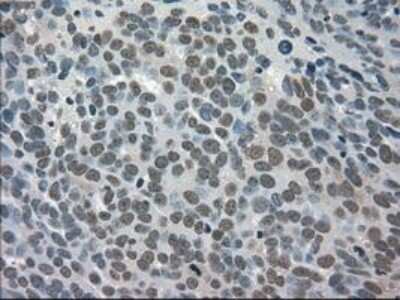 Immunohistochemistry-Paraffin: TRIB2 Antibody (OTI8D11) [NBP1-48030]