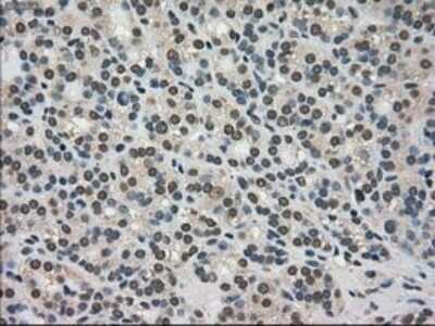 Immunohistochemistry-Paraffin: TRIB2 Antibody (OTI8D11) [NBP1-48030]