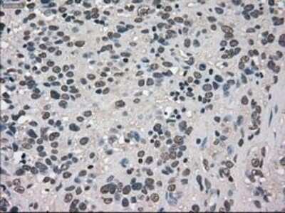 Immunohistochemistry-Paraffin: TRIB2 Antibody (OTI8D11) [NBP1-48030]