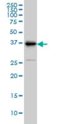 Western Blot: TRIB3 Antibody (2D1) [H00057761-M08]