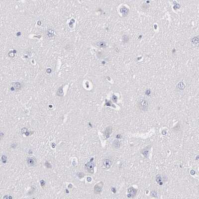 Immunohistochemistry-Paraffin: TRIM Antibody [NBP1-89660]
