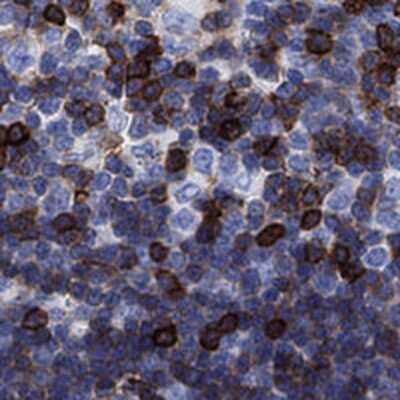 Immunohistochemistry-Paraffin: TRIM Antibody [NBP3-17096]