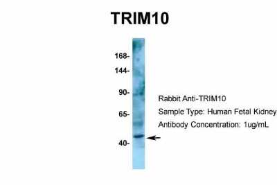 Western Blot: TRIM10 Antibody [NBP2-85982]
