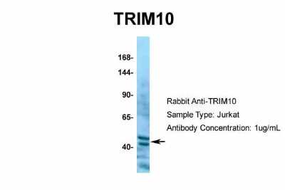 Western Blot: TRIM10 Antibody [NBP2-85982]