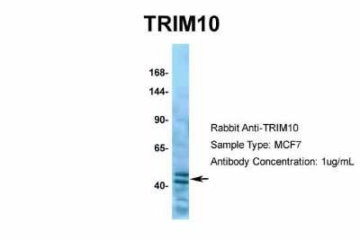 Western Blot: TRIM10 Antibody [NBP2-85982]