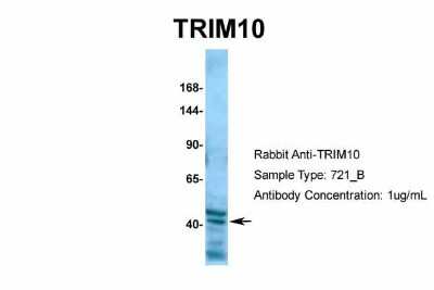 Western Blot: TRIM10 Antibody [NBP2-85982]