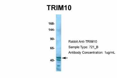Western Blot: TRIM10 Antibody [NBP2-85982]