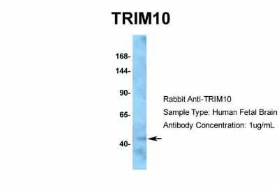 Western Blot: TRIM10 Antibody [NBP2-85982]
