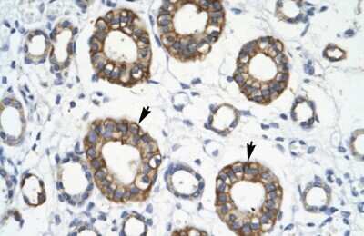 Immunohistochemistry: TRIM13 Antibody [NBP2-88466]