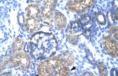 Immunohistochemistry: TRIM15 Antibody [NBP2-82360]