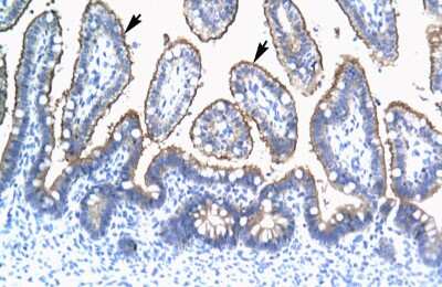 Immunohistochemistry: TRIM15 Antibody [NBP2-82360]