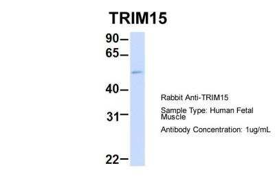 Western Blot: TRIM15 Antibody [NBP2-82361]