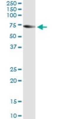Immunoprecipitation: TRIM16 Antibody (5F4) [H00010626-M01]