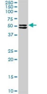 Western Blot: TRIM16 Antibody [H00010626-D01P]