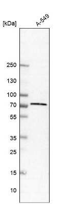 Western Blot: TRIM16 Antibody [NBP1-84921]