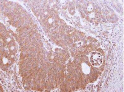Immunohistochemistry-Paraffin: TRIM17 Antibody [NBP2-20708]