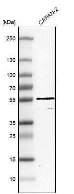 Western Blot: TRIM21/SSA1 Antibody [NBP1-87122]