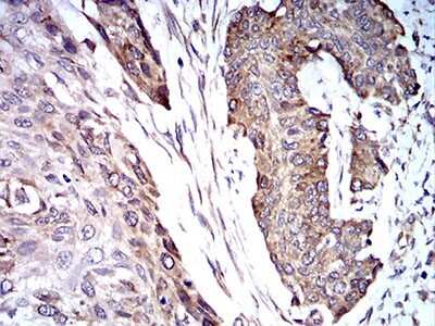 Immunohistochemistry: TRIM25 Antibody (5B5B10) - BSA Free [NBP2-61820]