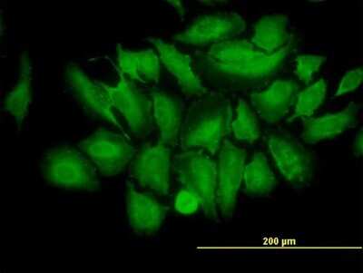 Immunocytochemistry/ Immunofluorescence: TRIM25 Antibody (5C3) [H00007706-M03]
