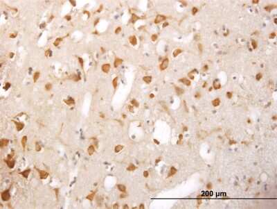 Immunohistochemistry-Paraffin: TRIM25 Antibody (5C3) [H00007706-M03]