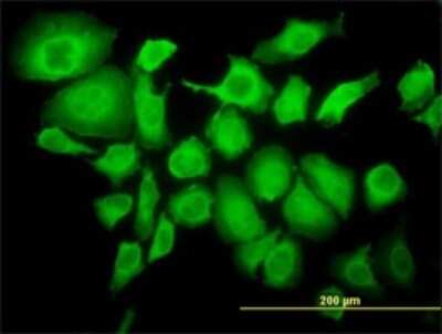 Immunocytochemistry/ Immunofluorescence: TRIM25 Antibody (5F12) [H00007706-M02]
