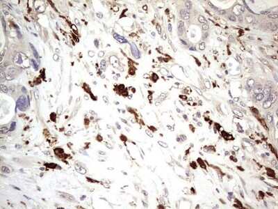 Immunohistochemistry: TRIM27 Antibody (OTI4D4) [NBP2-46214]