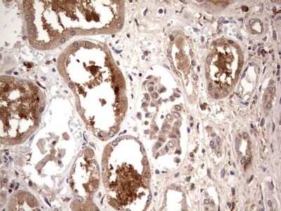 Immunohistochemistry: TRIM27 Antibody (OTI4D4) [NBP2-46214]