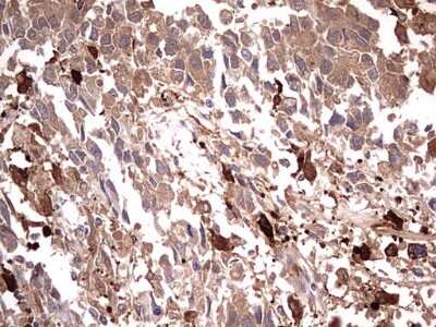 Immunohistochemistry: TRIM27 Antibody (OTI4D4) [NBP2-46214]