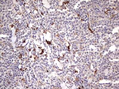 Immunohistochemistry: TRIM27 Antibody (OTI4D4) [NBP2-46214]