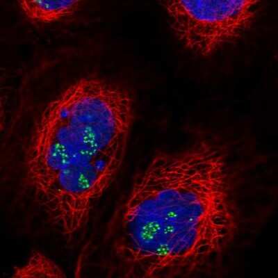Immunocytochemistry/ Immunofluorescence: TRIM27 Antibody [NBP2-54993]