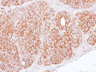 Immunohistochemistry-Paraffin: TRIM27 Antibody [NBP1-32098]