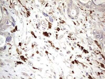 Immunohistochemistry: TRIM27 Antibody (OTI4D4) - Azide and BSA Free [NBP2-74609]
