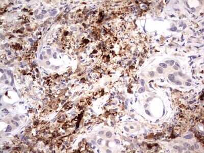 Immunohistochemistry: TRIM27 Antibody (OTI4D4) - Azide and BSA Free [NBP2-74609]