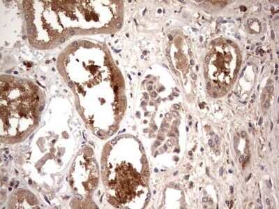 Immunohistochemistry: TRIM27 Antibody (OTI4D4) - Azide and BSA Free [NBP2-74609]