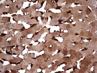Immunohistochemistry: TRIM27 Antibody (OTI4D4) - Azide and BSA Free [NBP2-74609]