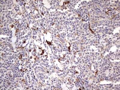 Immunohistochemistry: TRIM27 Antibody (OTI4D4) - Azide and BSA Free [NBP2-74609]