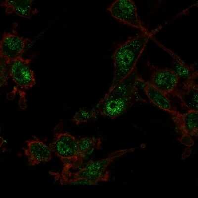 Immunocytochemistry/ Immunofluorescence: TRIM27 Antibody (PCRP-TRIM27-1B3) - Azide and BSA Free [NBP3-08579]